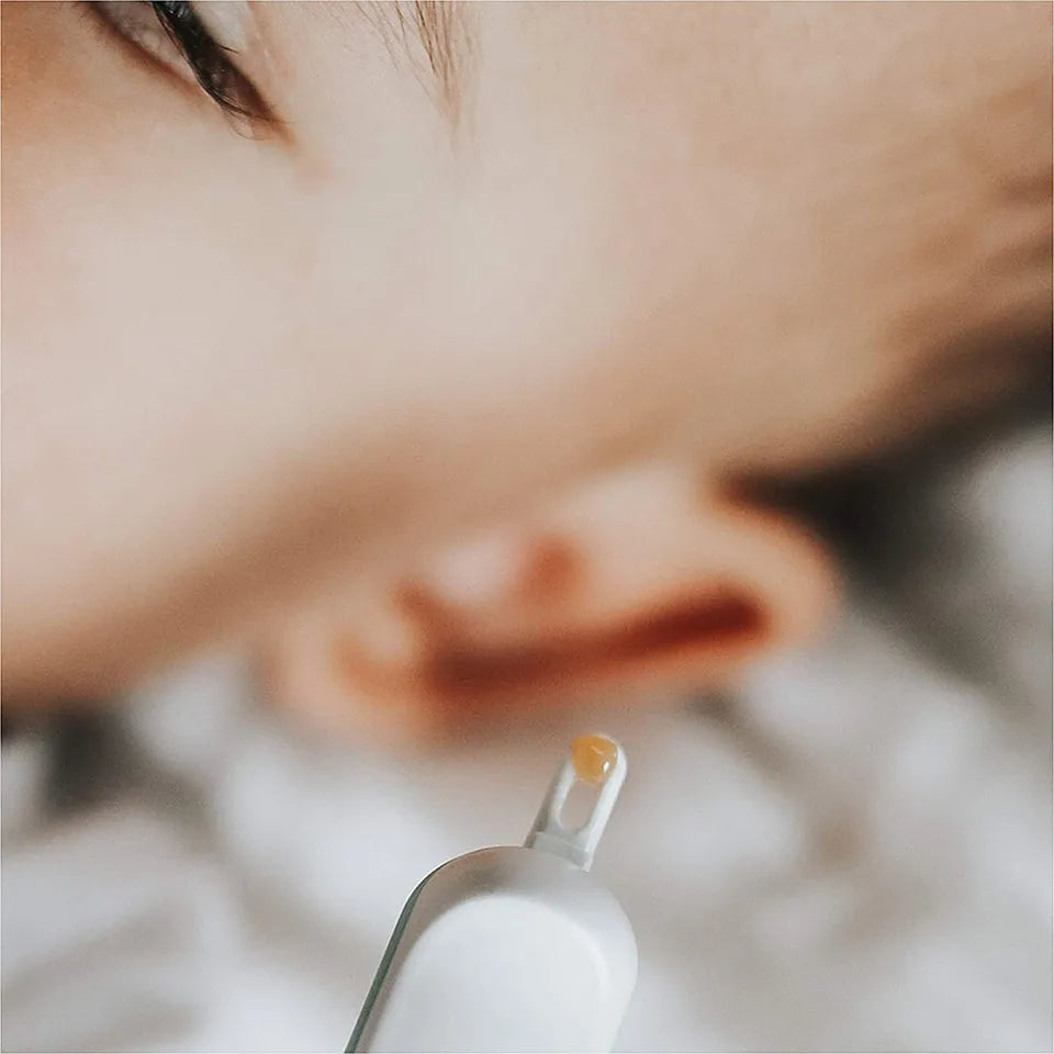 Frida Baby 3-in-1 Nose, Nail + Ear Picker- ESSENTIAL BOOGER PICKER TOOL
