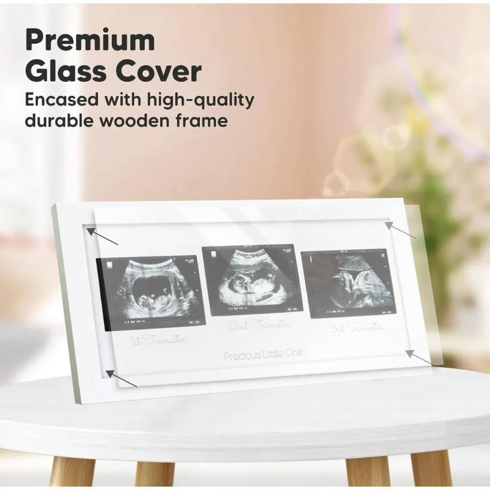 Keababies Trio Sonogram Frame - Alpine White