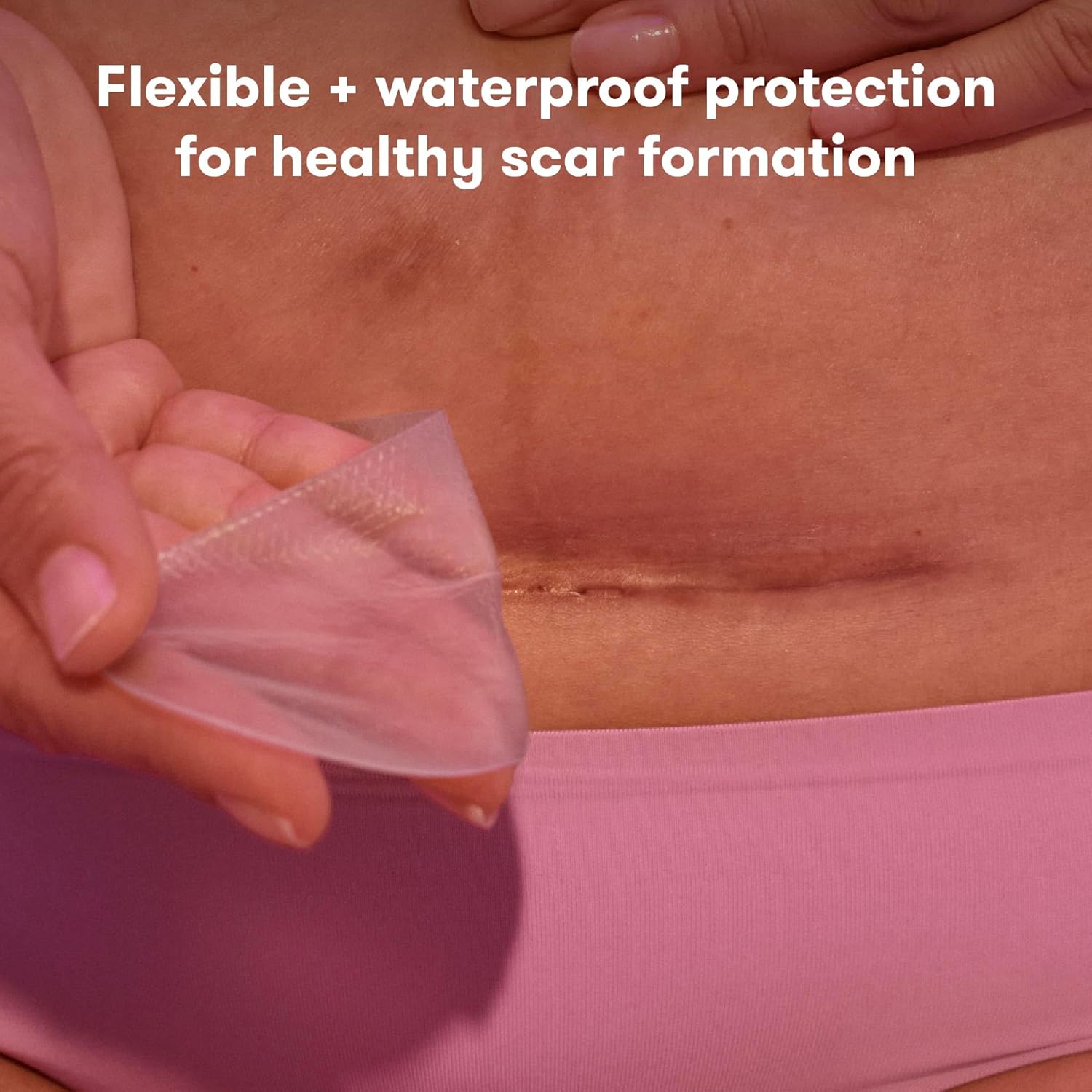 Frida Mom C-Section Silicone Scar Patches - 6 ct