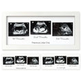 Keababies Trio Sonogram Frame - Alpine White