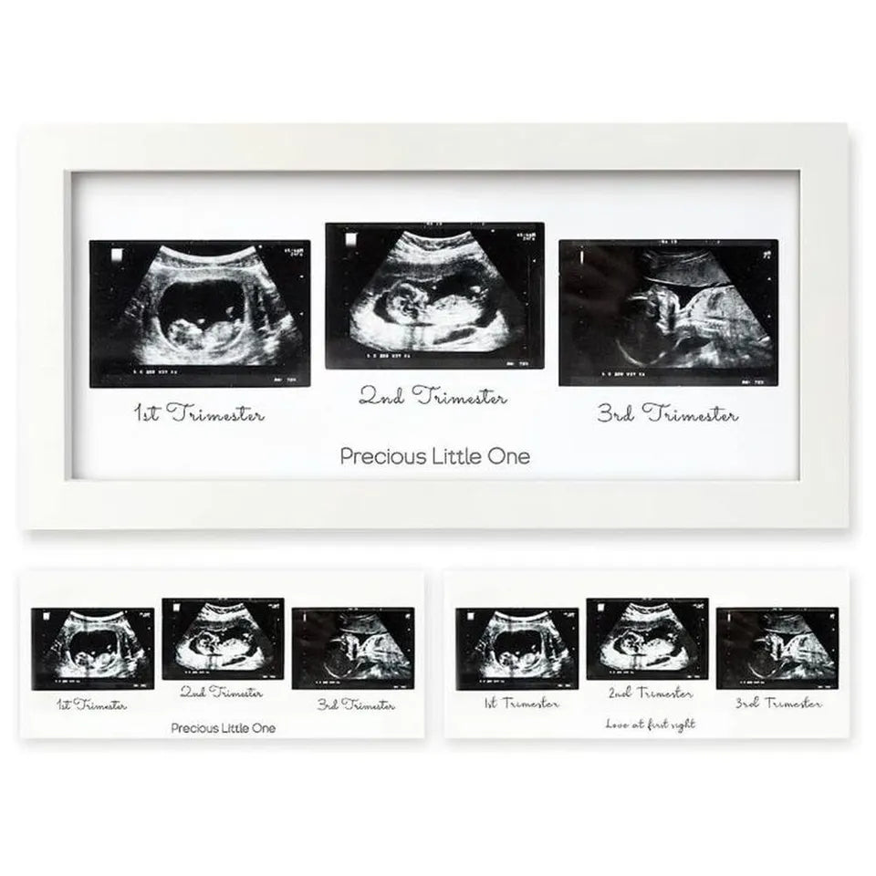 Keababies Trio Sonogram Frame - Alpine White
