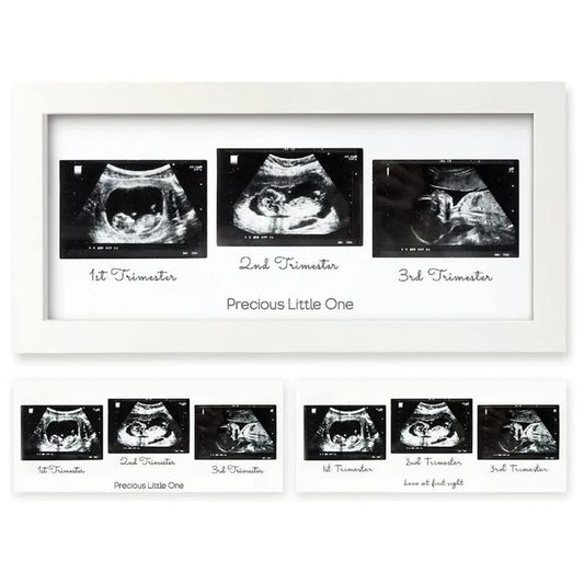 Keababies Trio Sonogram Frame - Alpine White