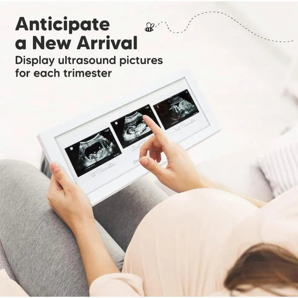 Keababies Trio Sonogram Frame - Alpine White