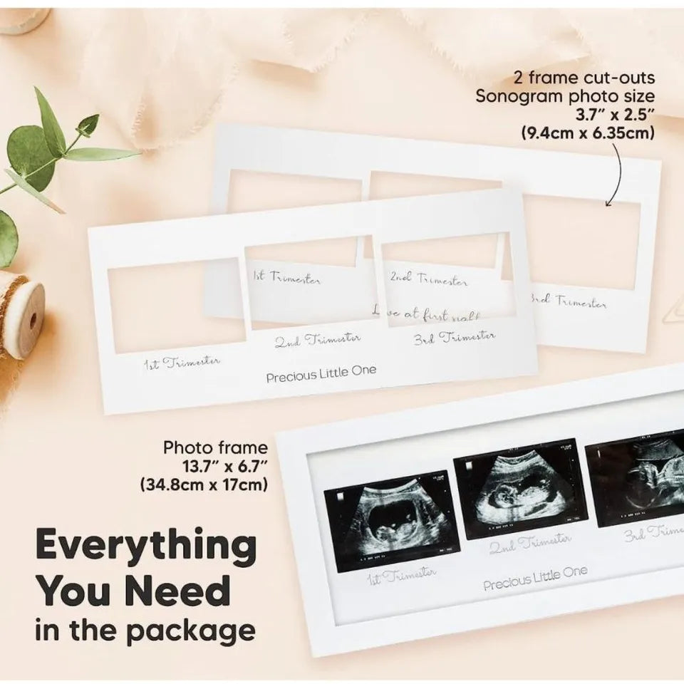 Keababies Trio Sonogram Frame - Alpine White