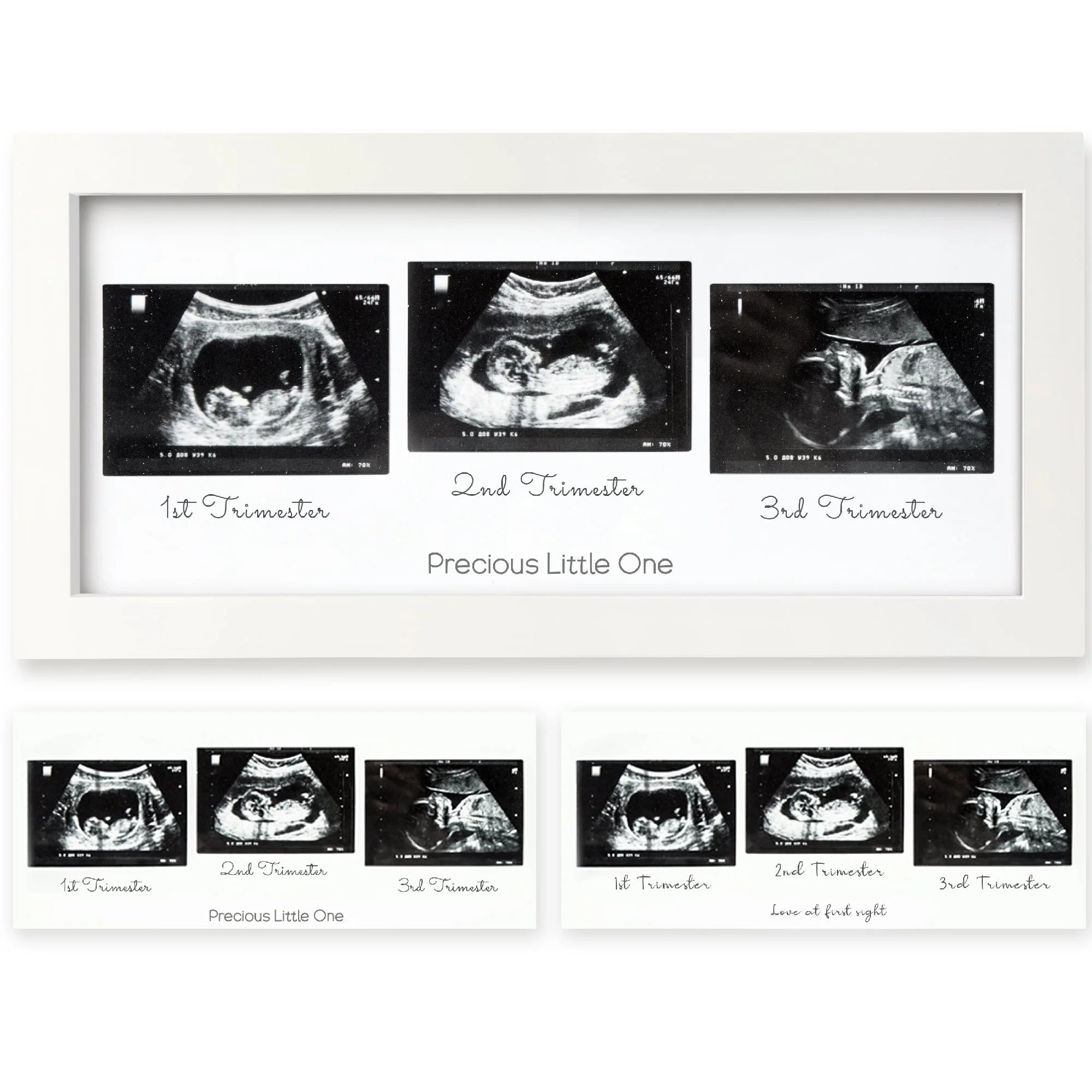 Keababies Trio Sonogram Frame - Alpine White
